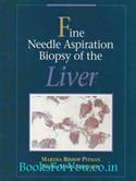 Fine Needle Aspiration Biopsy Of The Liver
